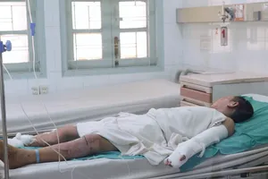 Liên tiếp 3 trẻ nhập viện do tự chế pháo nổ