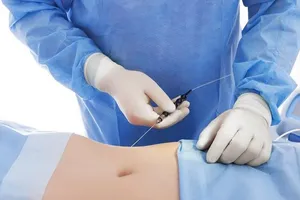 Sở Y tế TP.HCM yêu cầu Bệnh viện đa khoa Gia Định tạm ngưng phẫu thuật hút mỡ