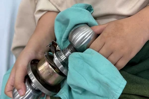 Hi hữu: Bé trai 5 tuổi bị kẹt ngón tay cái vào ổ khóa 