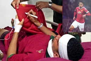 Sao MU nhập viện ở Bali vì bị… sứa cắn