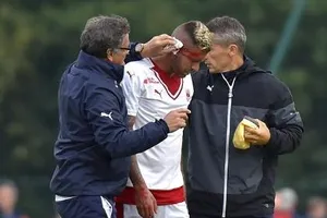 Ngôi sao đội tuyển Pháp bị mất một mảng tai sau va chạm hi hữu