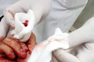 Đề nghị công an điều tra vụ nhà báo Đỗ Doãn Hoàng bị hành hung