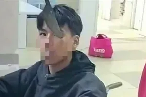 Biểu diễn múa dao, thiếu niên bị dao cắm vào hốc mắt