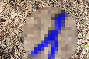 Truy tìm tung tích người đàn ông có bốn răng cửa hàm trên bọc sứ