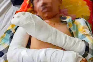 Mua thuốc về chế tạo pháo, 1 học sinh bị thương nặng