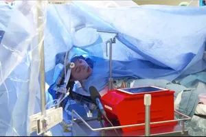 Phát trực tiếp phẫu thuật não không gây mê lên Facebook