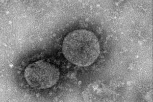 Hong Kong nói về thời gian hoàn thiện vaccine ngừa corona