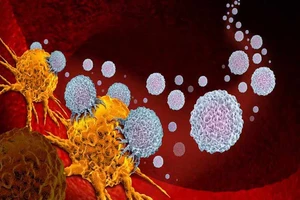 Tỷ lệ mắc ung thư ở các nước nghèo sẽ tăng cao trong vòng 20 năm tới. Ảnh: GOOD NEWS NETWORK