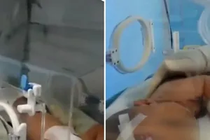 Tiếu Tiếu trong thời gian mới sinh ra ở bệnh viện Nhi Đồng Vũ Hán. Ảnh: CCTV