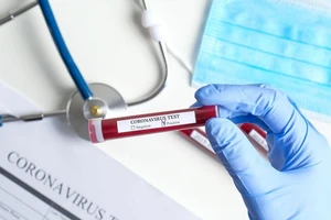 Trung tâm Kiểm soát và phòng ngừa dịch bệnh Mỹ thay đổi tiêu chí xác định đối tượng nghi nhiễm COVID-19. Ảnh: THE JAKARTA POST