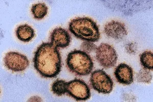 Ảnh chụp virus gây dịch COVID-19 dưới kính hiển vi. Ảnh: GETTY