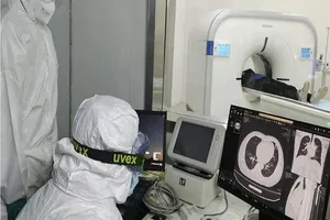 Các nhà nghiên cứu thấy rằng virus gây dịch COVID-19 vẫn còn tồn tại trong phổi người đã khỏi bệnh. Ảnh: TÂN HOA XÃ