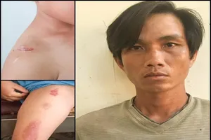 Tạm giam cha dượng hành hạ cháu bé 6 tuổi