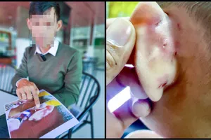 Kiên Giang: Khởi tố cô giáo bạo hành trẻ khi cho ăn