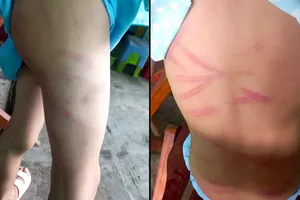 Công an Hậu Giang đang làm rõ vụ mẹ ruột nhiều lần đánh đập con