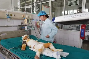 Sức khỏe 3 trẻ bị bỏng nặng vụ cô giáo dùng cồn dạy PCCC