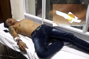 Hàng chục người tấn công xe khách, đánh dã man tài xế