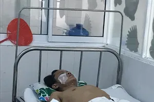 Nổ thiết bị trong nhà máy gạch, 4 công nhân bị bỏng