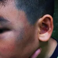 Tòa lại hoãn vụ tài xế xe ôm công nghệ đánh cháu bé ở quận 7