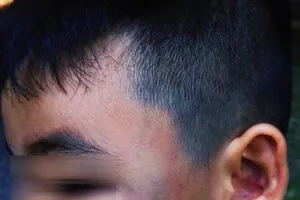 Gia đình cháu bé bị xe ôm đánh muốn tòa xử công khai 