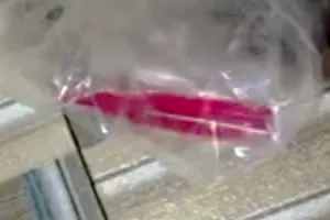 Cứu sống cô gái bị ngộ độc thuốc diệt chuột có độc tính cực cao