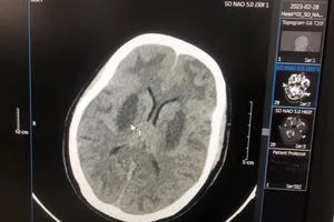 Vụ nhiễm độc methanol ở Bắc Ninh: Chuyên gia cảnh báo nguy cơ và cách phòng tránh