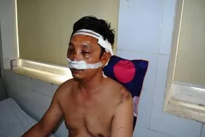 Chưa gắp được dị vật trong đầu nạn nhân bị bắn