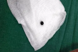 Bé 8 tuổi trúng đạn từ súng tự chế của hàng xóm