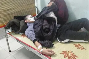 Bị bỏng nặng khi dùng lửa thử xăng 