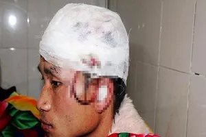 Vào rừng hái lá dong, bị gấu tấn công trọng thương 