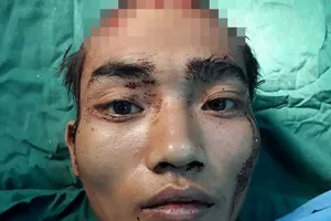 Ảo giác, chồng giết chết con, vợ bị thương