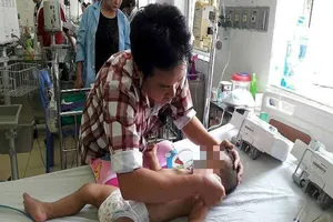 Đàn ong vây kín chích bé 19 tháng tuổi hàng trăm mũi