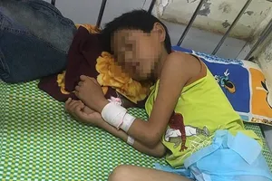 Bị bạn thách, bé trai uống hết 1 lít rượu đế bị tổn thương não