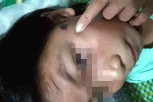  Công an viên tra khảo bé gái 12 tuổi bầm tím mông 