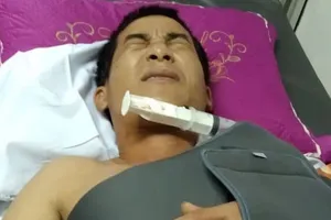 Bị chém gãy xương tay, khâu 21 mũi vì làm đứt dây cáp quang 