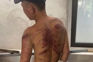 1 phụ nữ cho vay lãi nặng, tra tấn con nợ bằng dây điện