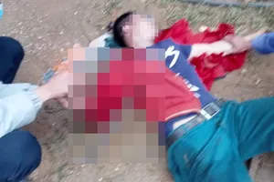  Bị cây sắt đâm xuyên qua ngực, người đàn ông nguy kịch