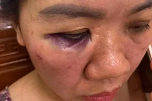 Vụ nữ nhân viên điện lực bị tấn công: Tạm đình chỉ công tác 2 người 