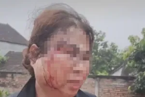 Con ủng hộ mẹ ‘đi bước nữa’ nhưng mẹ bị chồng trẻ bạo hành dã man 