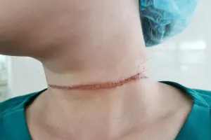 Cảnh báo tai nạn từ thả diều