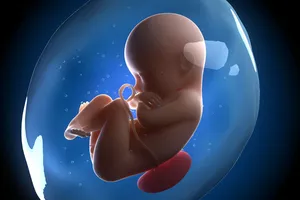 Phát hiện 'con' nằm trong bụng mẹ 36 năm