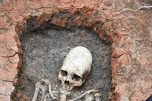 Tìm thấy bộ xương 2000 tuổi đầu hình nón, nghi người ngoài hành tinh