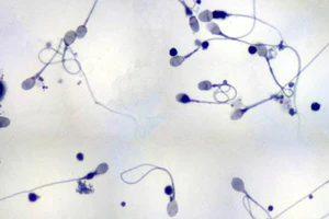 Khám phá: Nuôi tinh trùng trong ống nghiệm