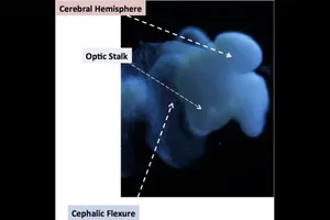 Não nhân tạo lớn gần bằng não người, giúp điều trị 'bá bệnh'
