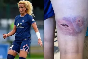 Cầu thủ của PSG bị tấn công kinh hoàng và nghi án 'dan dan díu díu mập mờ'