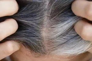 3 loại phụ liệu thực phẩm giúp ngăn ngừa tóc bạc sớm