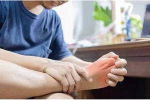 5 cách tự nhiên để kiểm soát nồng độ axit uric trong cơ thể