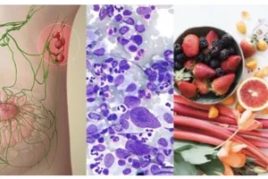 Chế độ ăn uống có thể làm giảm nguy cơ ung thư