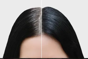 5 biện pháp tự nhiên bảo vệ tóc không bị bạc sớm