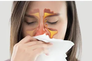 5 loại thực phẩm giúp giảm đau khi bị viêm xoang 